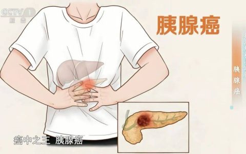 炎症是“小病”？别拖，小心发展成“癌中之王”！做好这5件事，癌细胞都怕你