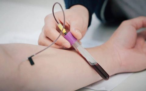 身体出现这4个表现，可能是血管正在“提前”老化！别等中风心梗才后悔