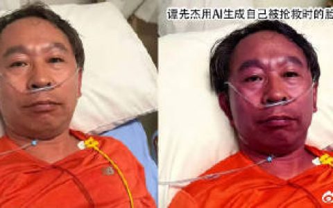 协和专家吃头孢过敏进抢救室