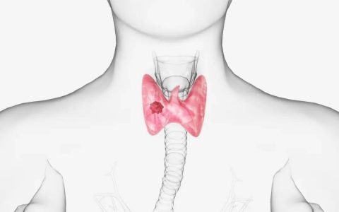 体检查出甲状腺结节，有必要做穿刺活检吗？