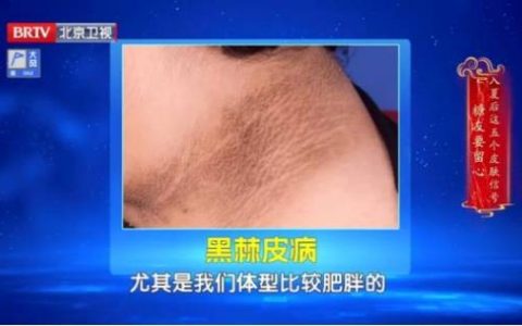 这些地方“洗不干净”？赶紧查这项指标