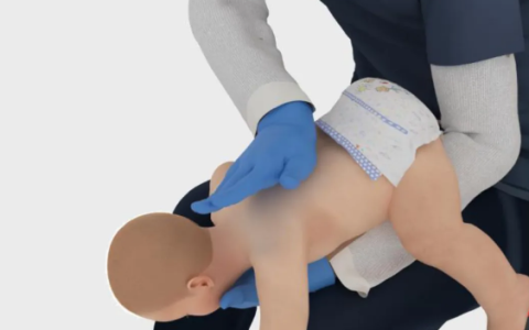 海姆立克急救法更新了：先拍5次背 再做“剪刀石头布”