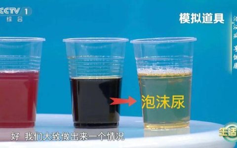 喝水后4个异常，可能是肾发出的“求救信号”！