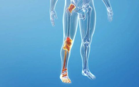腿疼别总盯着“骨头”，可能是血管在报警