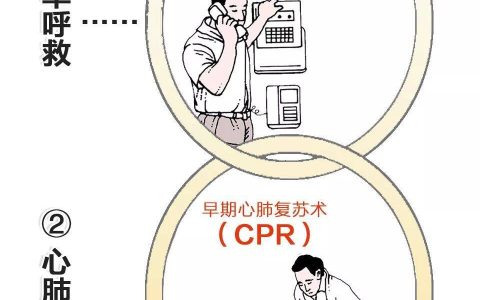 有濒死感，且持续20分钟以上！出现“心源性猝死”，请马上这样做